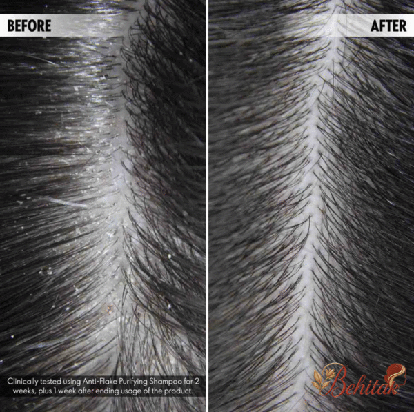 شامپو ضد شوره و ضدپوسته مو دئولوگی - تصویر 2