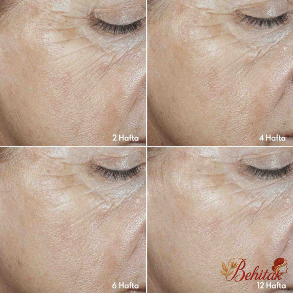 ست ضدچروک و کلاژن ساز رینکل اسموت نوایج پلاس - تصویر 2